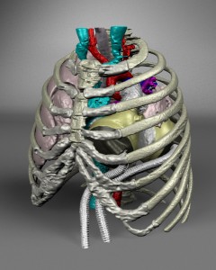 artificial heart device