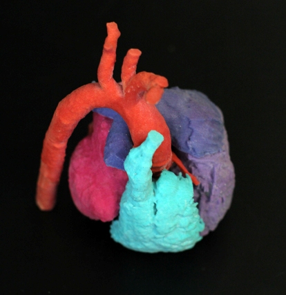 3-D technology boosts project to aid heart surgery