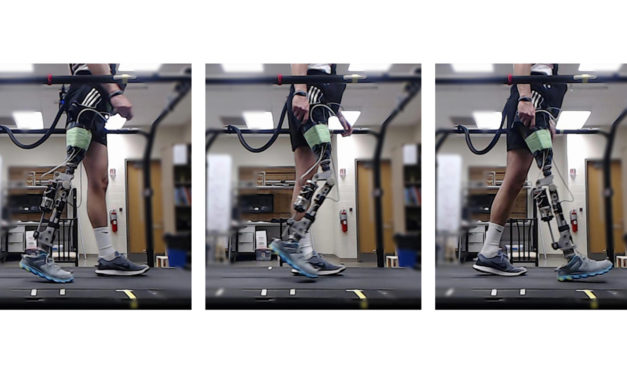 Reinforcement learning expedites ‘tuning’ of robotic prosthetics