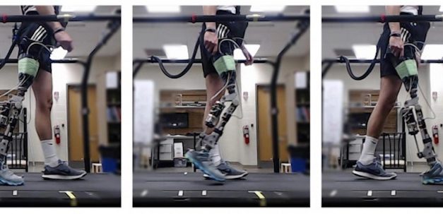 Powered prosthetic knee users able to walk in minutes