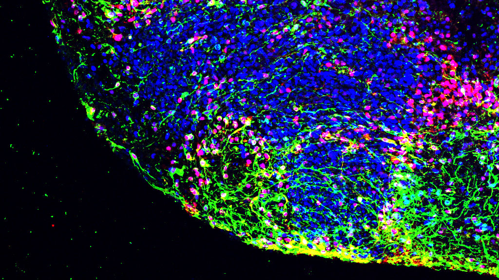 An image of proteins present in brain tissue.